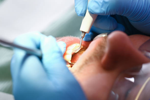 Best Emergency Treatment for Toothache in Fredericksburg, IA