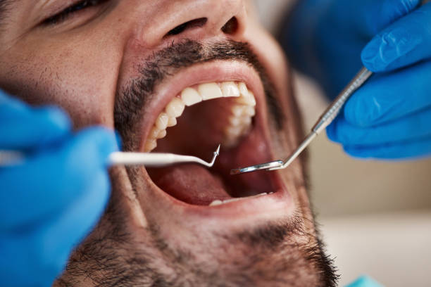 Best Pediatric Emergency Dentist in Fredericksburg, IA