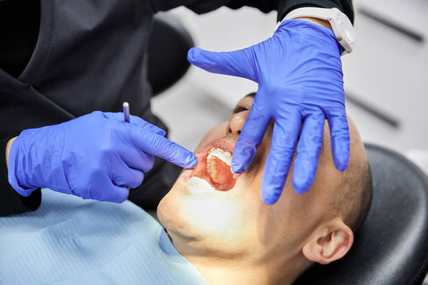 Best Emergency Broken Tooth Repair in Fredericksburg, IA